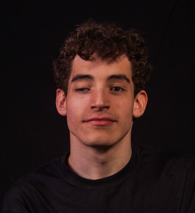 Imagen del rostro de Antón con fondo negro